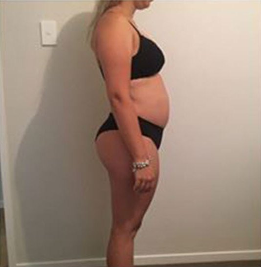 Elizabeth Cawston before HCG diet NZ