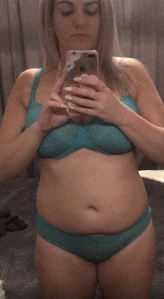 Jessica Reid before HCG weight loss NZ