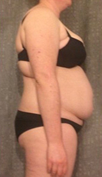 Carrie J before HCG drops NZ