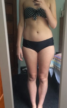 Sally before HCG diet NZ