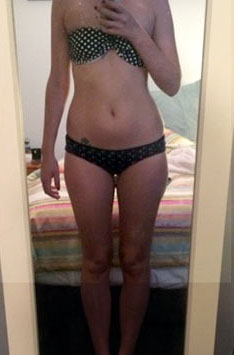 Sally after HC-SLIM NZ – 15kg lost